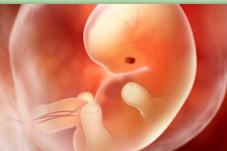 Miscarriage