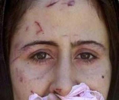 Syrian Rape Victim at Turkish Refugee Camp