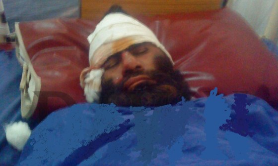 Madressa e Hussainia , Peshawar Blast Suspect