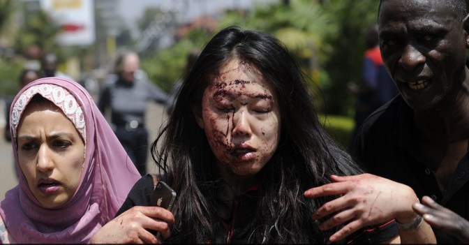 Injured by Shooting of terrorist @ Mall , Kenya , Nairobi 21.09.13 b