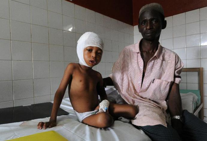 Young Muslim boy injured by a Christian Vigilante in Central Africa b