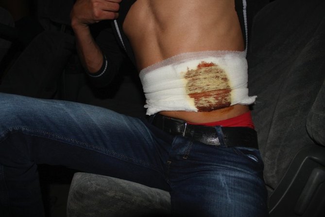 Desperate Syrians Involved in organ Trade