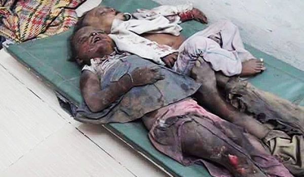 Saudi's Using Chemical Weapons on Yemeni Civilians